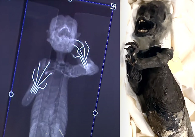Mysteriöse Fidschi-Meerjungfrau von Radiologiestudenten untersucht (Video)