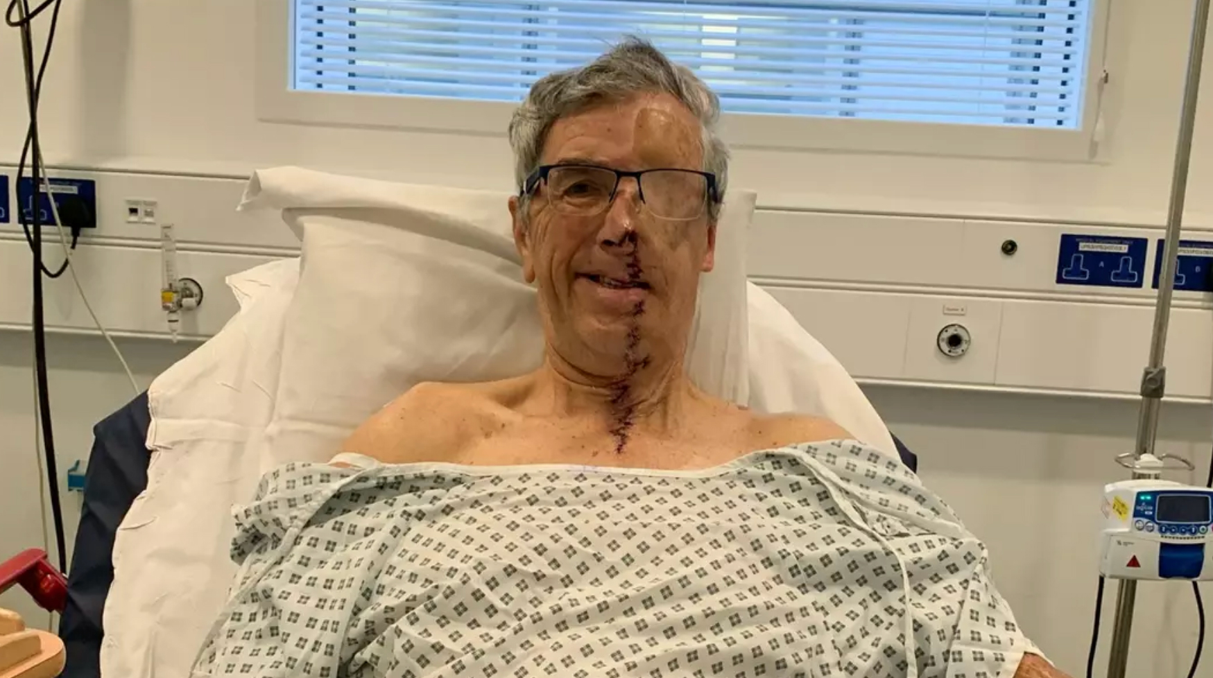 Unglaubliche Fotos zeigen das erste 3D-gedruckte Gesicht des NHS, nachdem es bei einem schrecklichen Unfall zerfetzt wurde