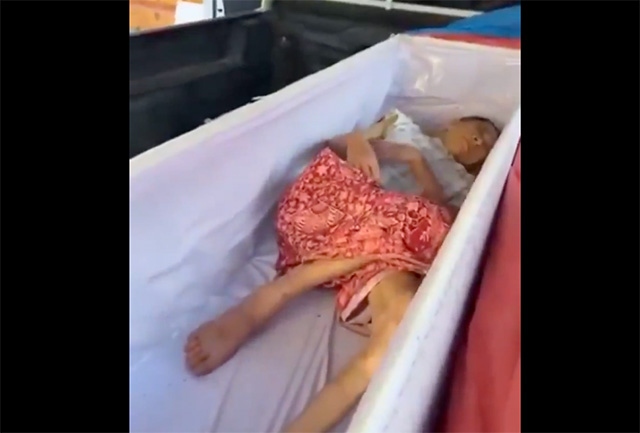 Lebend im Sarg: 65-Jährige entgeht nur knapp der eigenen Einäscherung (Video)