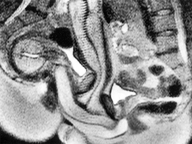 Ein Paar hatte Sex in einem MRT-Gerät, um herauszufinden, was während des Geschlechtsverkehrs im Körper passiert